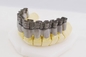 FCC 3D Tand Digitale 2060μM Crowns And Dentures 3D Printer van Printerdual fiber laser