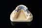 De medische Tandheelkundeslm 3D Printer van Printeradjustable thickness digital