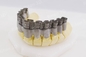 Enige van de het Metaalprinter van de Vezellaser 3D Industrie van For Dental Jewelry