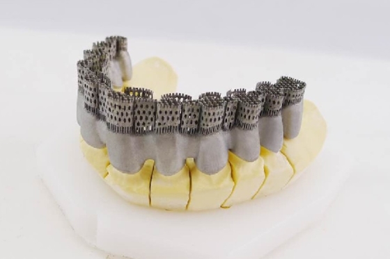 20μm het Tandmateriaal van de de Laserdruk van Large Dental Digital van de Metaal 3D Printer